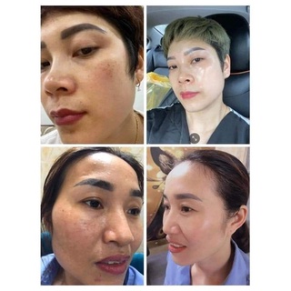 Serum căng bóng mờ thâm Mela White ADA GROUP