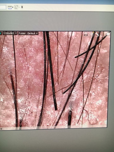 Kính Hiển Vi Điện Tử Dino-Lite Premier