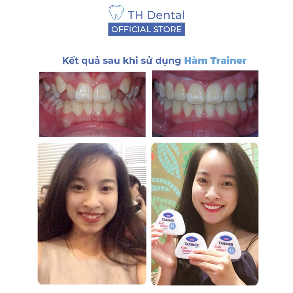 Niềng răng trong suốt tại nhà TRAINER - Bộ chỉnh nha dành cho người lớn, trẻ em A1 + A2 + A3