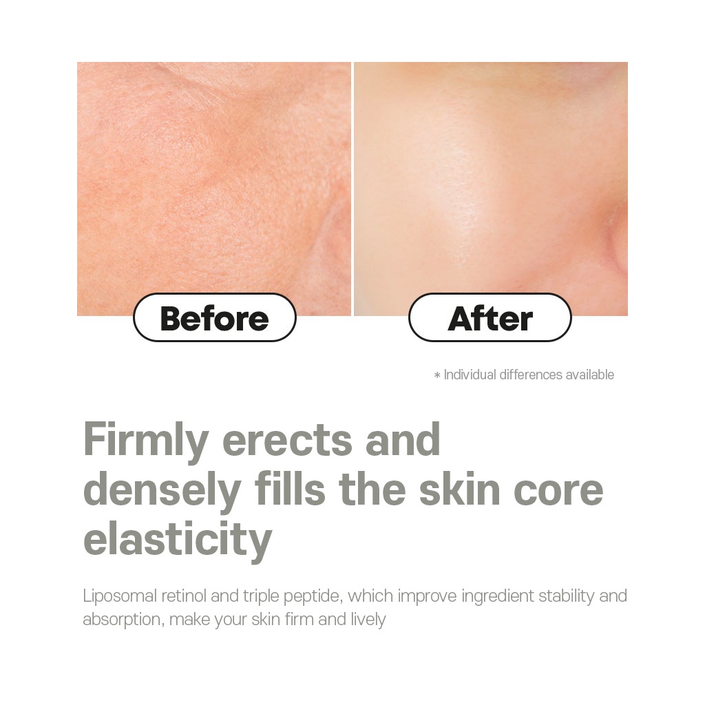 NatureONE - Kem Vitamin A Retinol 50g