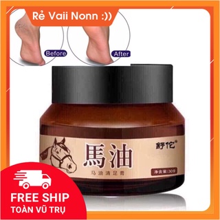 [Dầu Ngựa] Kem dầu ngựa bôi tay chân, cao ngựa giảm khô nứt nẻ gót chân á sừng bong da - shop_uytin88