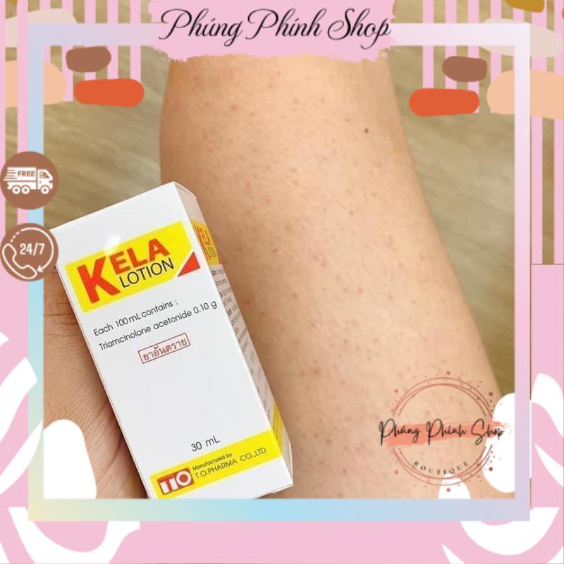 { HÀNG NỘI ĐỊA THÁI } Kela Lotion GIẢM VIÊM LỖ CHÂN LÔNG