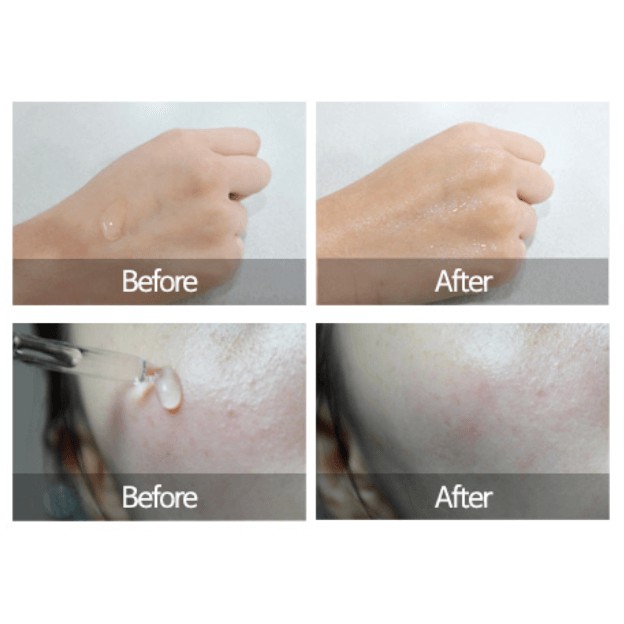 Tinh chất dưỡng ẩm cân bằng The Plant Base Waterfall Moist Balanced Hyaluronic Acid 100 20ml