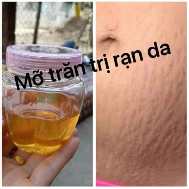Tinh chất triệt lông Mỡ trăn N'STORE by thanh nhi.(dạng mới có mã vạch) | BigBuy360 - bigbuy360.vn