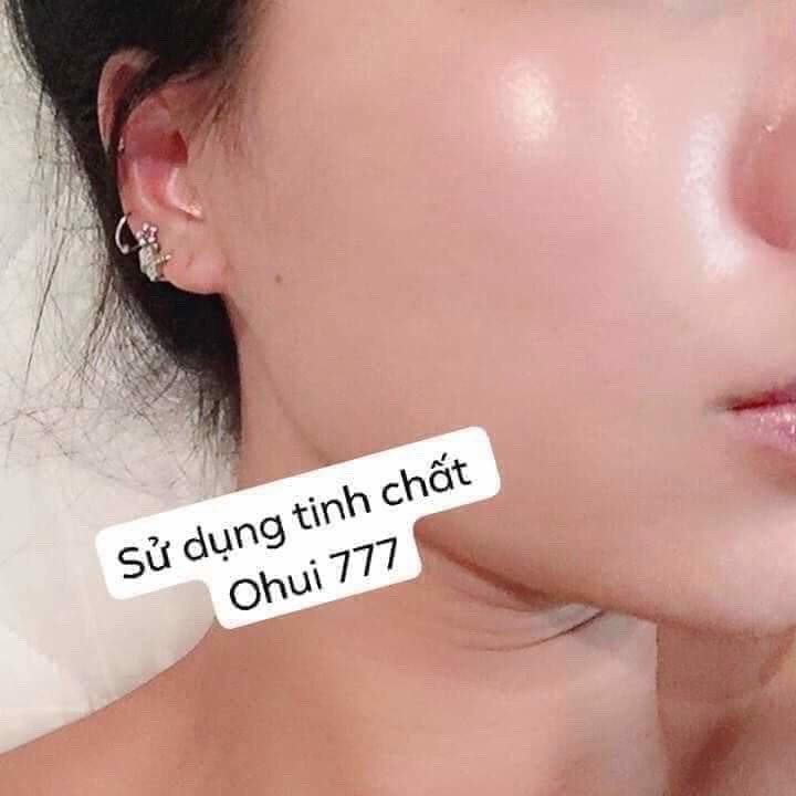 [siêu hót] 1 chai huyết thanh siêu dưỡng ẩm, cung cấp dưỡng căng bóng da sau 7 tuần - Ohui Miracle Moisture 777