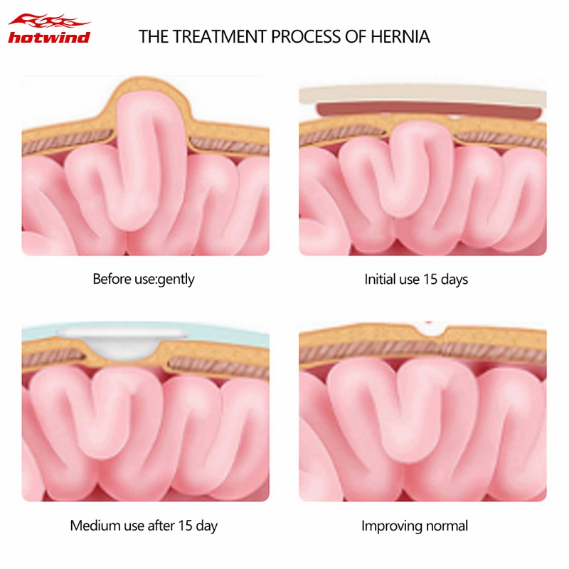 Hw (Hàng Mới Về) Set 2 Đai Quấn Bụng Thoáng Khí Bảo Vệ Rốn Cho Bé Sơ Sinh