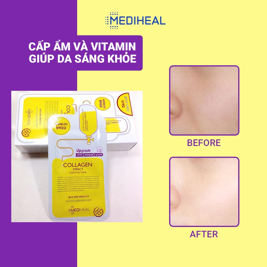 Mặt Nạ Collagen Ngăn Ngừa Lão Hóa Da Mediheal Collagen Impact Essential Mask EX 24ml [K3]