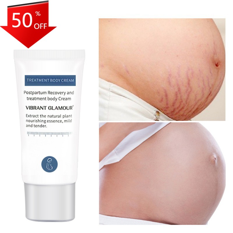 Ready Stock (hàng Mới Về) Kem hỗ trợ giảm Rạn Da Vibrant Glamor Giúp Da Săn Chắc Và Chống Lão Hóa Hiệu Quả COD | BigBuy360 - bigbuy360.vn