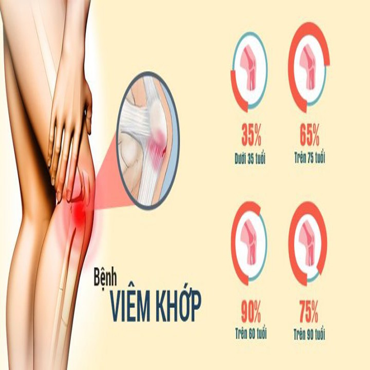 Gel Flekostell bôi xoa bóp giảm đau