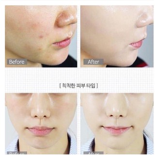 Phấn Nước Medicube