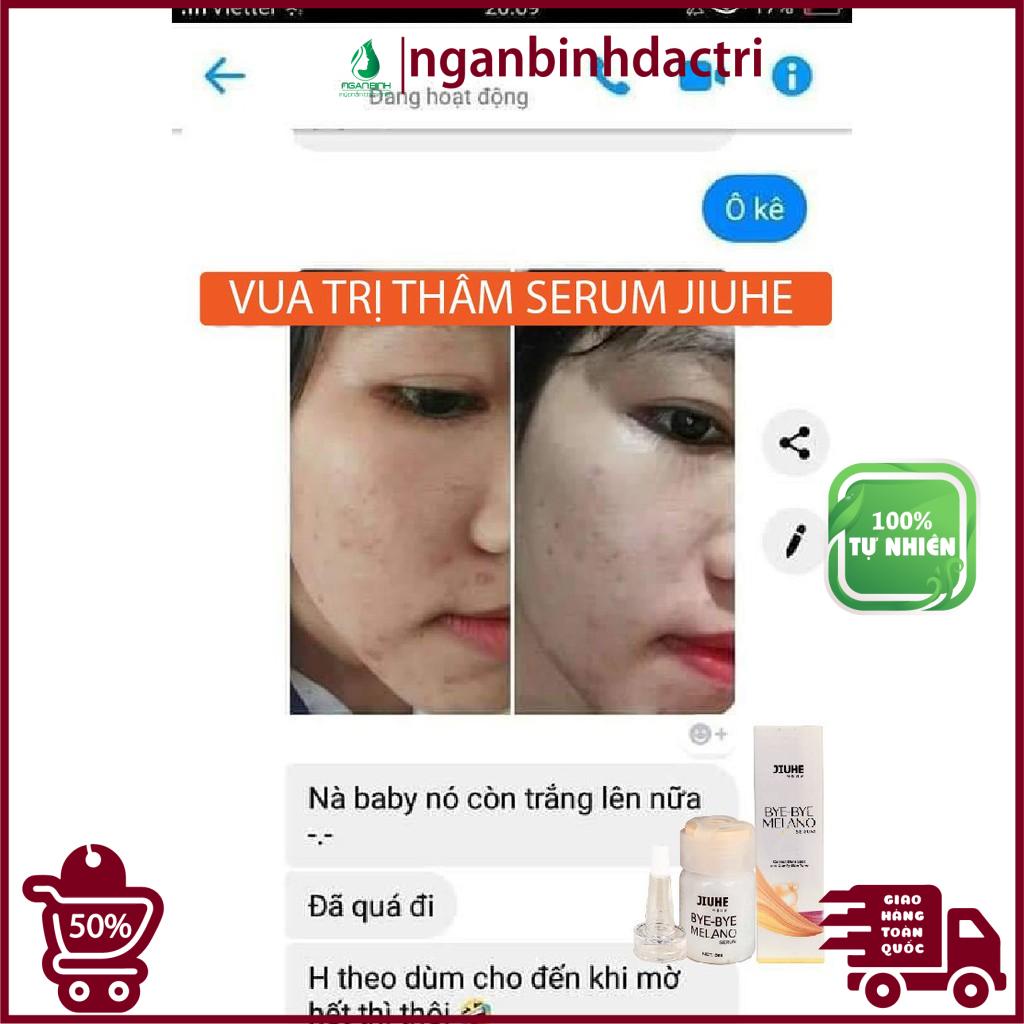 Serum tri thâm hàn quốc JIUHE Q-PEARL giảm thâm do mụn khửu tay chân, thâm sẹo, thâm nách hiệu quả