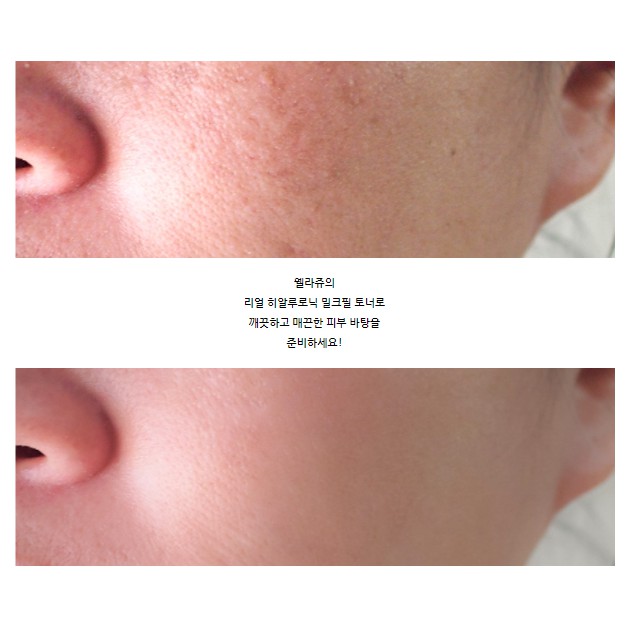 Nước dưỡng WELLAGE Real Hyaluronic Milk Peel Toner 300ml