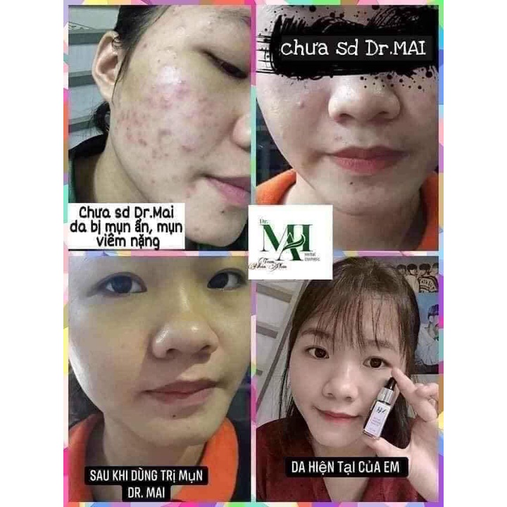 DR MAI NGUYÊN CHẤT 5ML