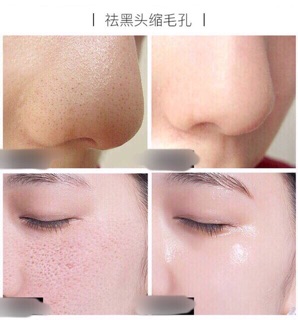 Tinh chất dưỡng shrinkage pore 30ml DD G204