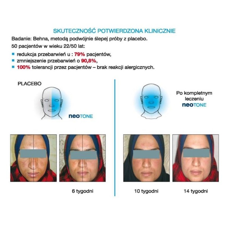 Kem chống nắng ISIS Pharma Neotone Radiance SPF50+ 30ml