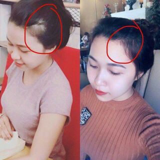 Xịt kích mọc tóc chanh bưởi Thái Lan