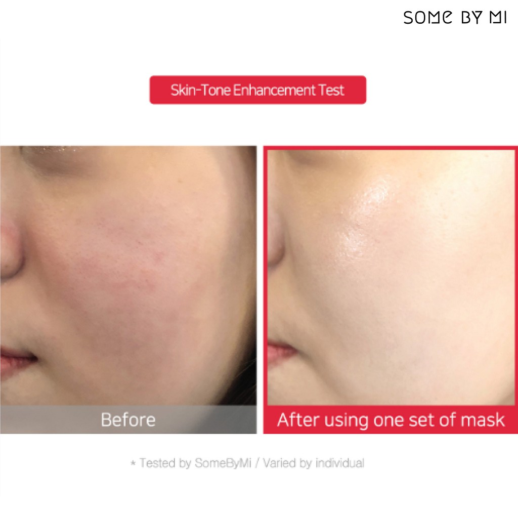 Mặt nạ Some By Mi Sheet Mask - Giảm Mụn Tea Tree - Dưỡng Trắng Diamond - Cấp Ẩm Hyaluron
