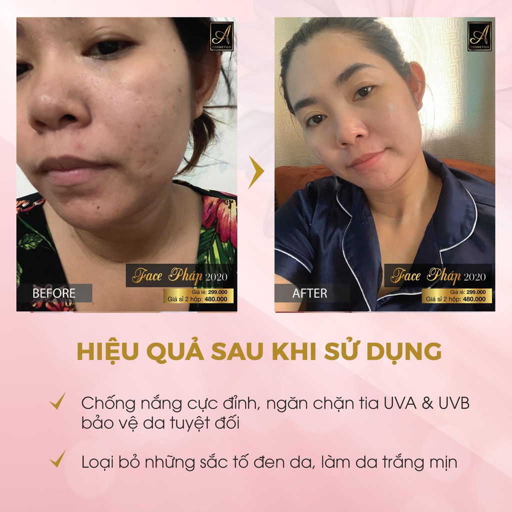 Kem Face Pháp Acosmetics - Kem dưỡng trắng da mặt - 50g - Giúp ngăn ngừa mụn, thâm nám tàn nhang,Hiệu quả chỉ sau 1 tuần | BigBuy360 - bigbuy360.vn