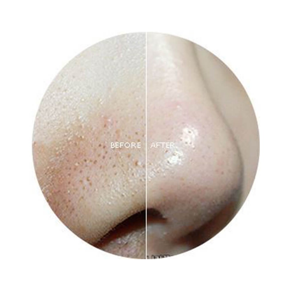 Miếng đẩy mụn Goodbye Blackhead | BigBuy360 - bigbuy360.vn