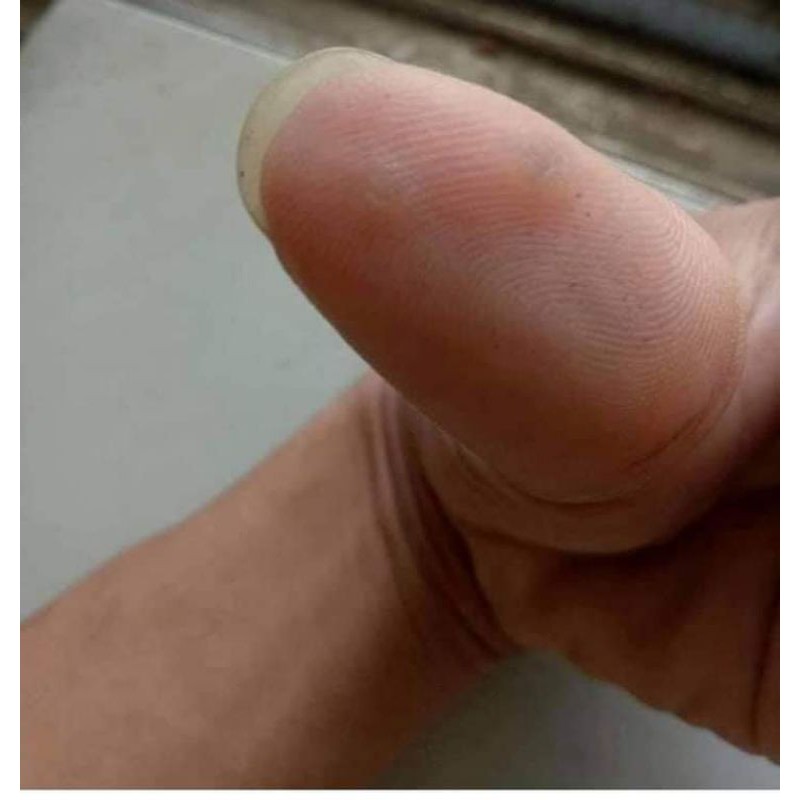 dung dịch diệt mụn cơm, mụn cóc, sạn cá | BigBuy360 - bigbuy360.vn