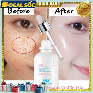 Serum Tinh Chất Căng Bóng Da sau 20 ngày VinvinSkin