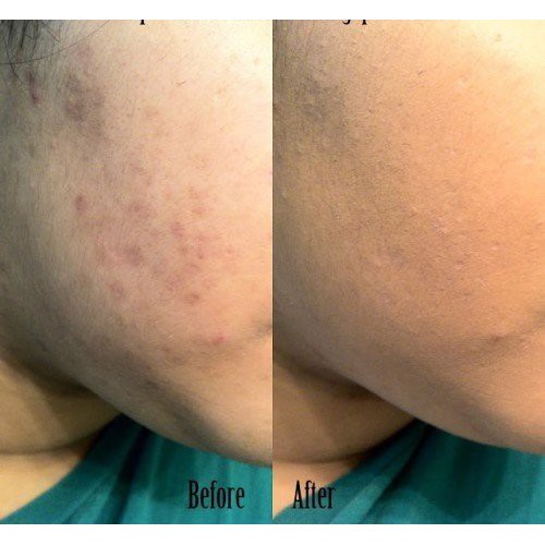 Phấn Tươi Đức ESSENCE SOFT TOUCH MOUSSE | BigBuy360 - bigbuy360.vn