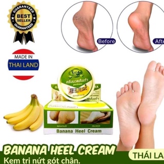 Kem bôi nứt gót chân Chuối Thái Lan