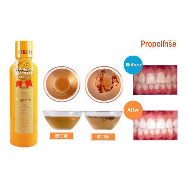 Nước súc miệng Propolinse Màu Cam Diệt Khuẩn Chống Hôi Miệng Làm Trắng Răng 600ml [Nhãn Bóng Không Chứa Cồn]