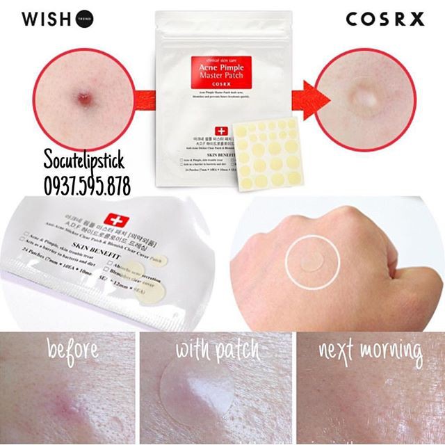 Miếng Dán Mụn Cosrx Acne Pimple Master Patch 24 Miếng Màu Đỏ | Hút Mụn Clear Fit Master Patch 18 Miếng Màu Đen