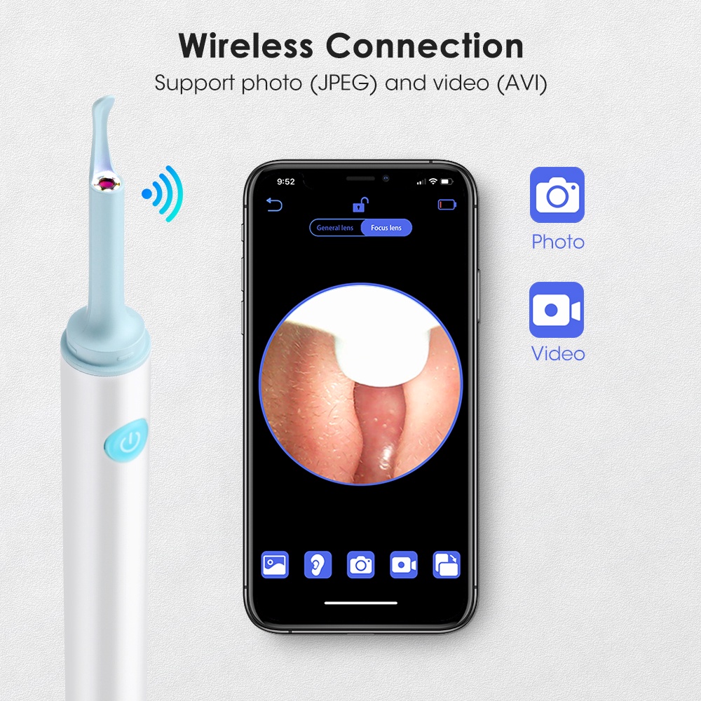 Dụng Cụ Lấy Ráy Tai Thông Minh 3.9mm An Toàn Cho Bé
