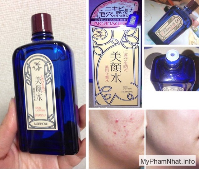 LOTION DA MỤN MEISHOKU BIGANSUI NHẬT BẢN