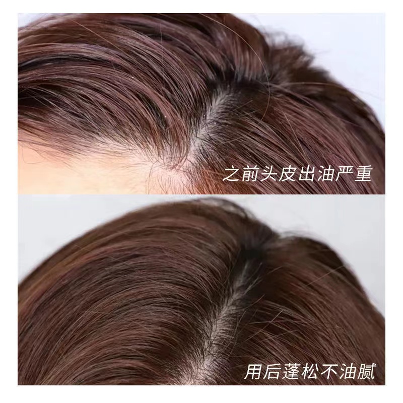Dầu Gội Muối Biển Hỗ trợ giảm vẩy nến Và Ngứa Da Đầu 300g