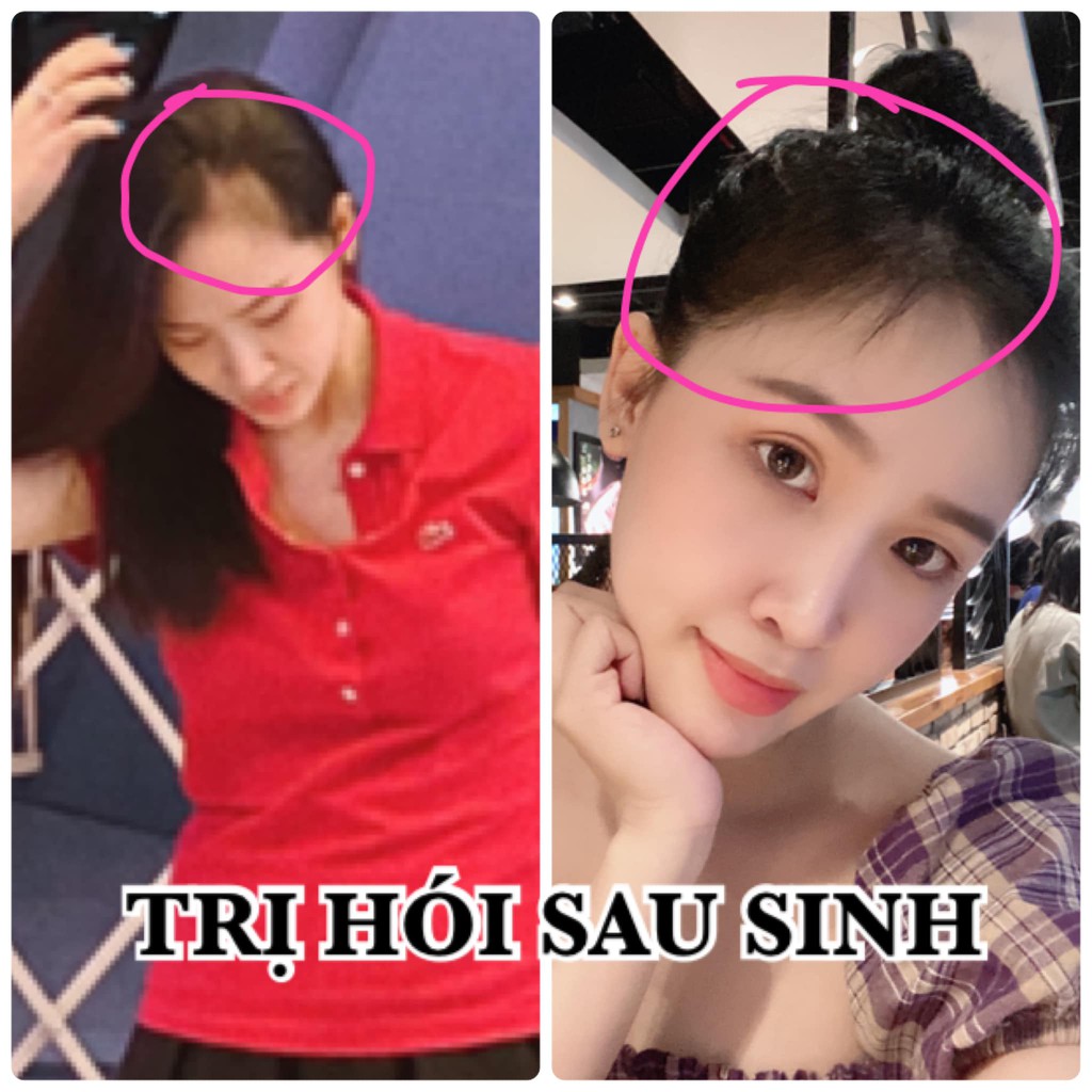 XỊT TÓC TINH DẦU BƯỞI | BigBuy360 - bigbuy360.vn