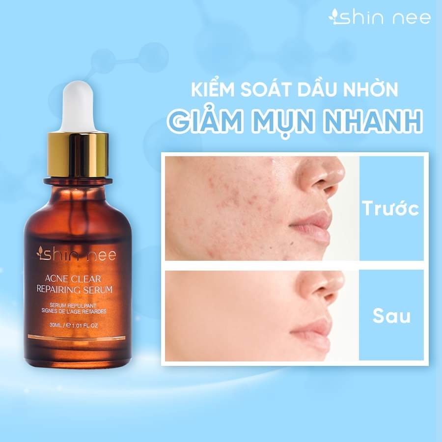 Tinh chất giảm mụn ngừa thâm cấp ẩm- Serum Acne Repairing Shin Nee - 35ml