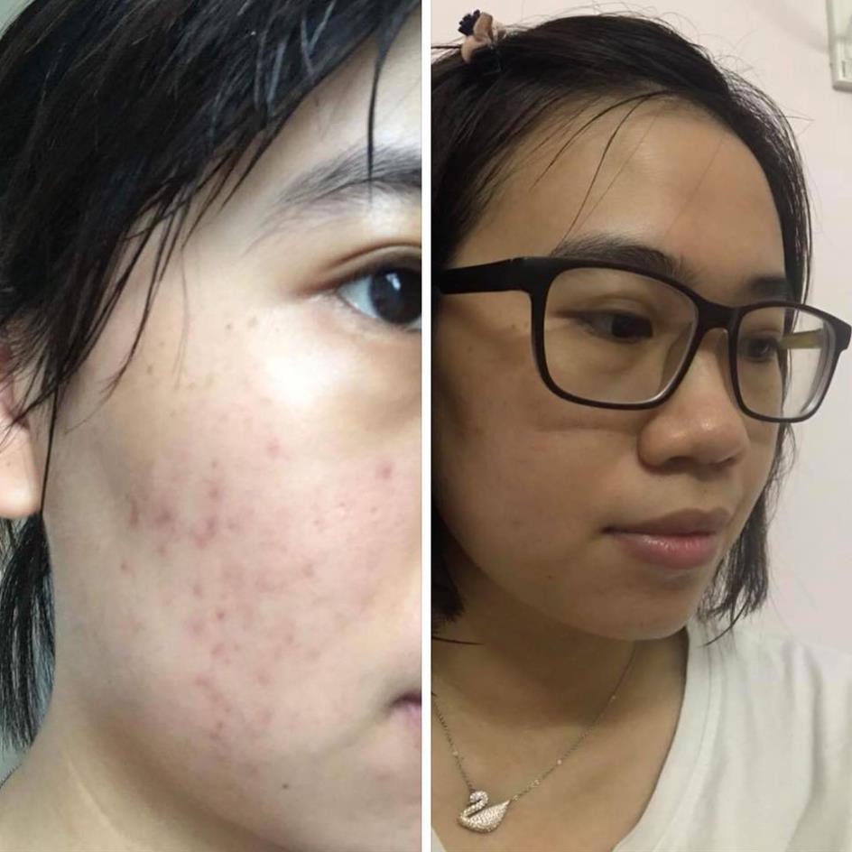 Tinh chất Serum SkinCeuticals C E Ferulic Minisize 4ml CEF