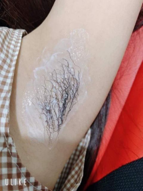 Kem tẩy lông,serum triệt lông vĩnh viễn | BigBuy360 - bigbuy360.vn