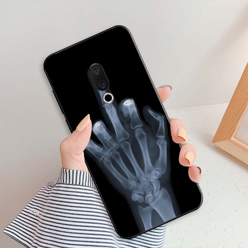 Ôp Điện Thoại Silicon Dẻo Họa Tiết Hoạt Hình Dễ Thương Cho meizu 15 / 15 plus 15plus Ốp