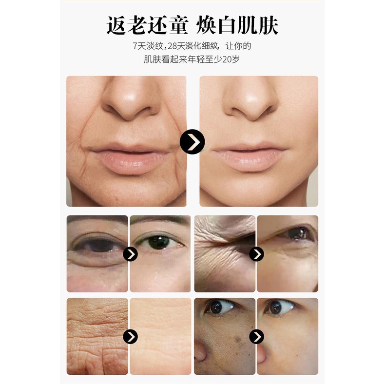 Kem polypeptide Yanjiayi 50g Dưỡng Ẩm Làm Săn Chắc Da Chống Nếp Nhăn Làm Trắng Da