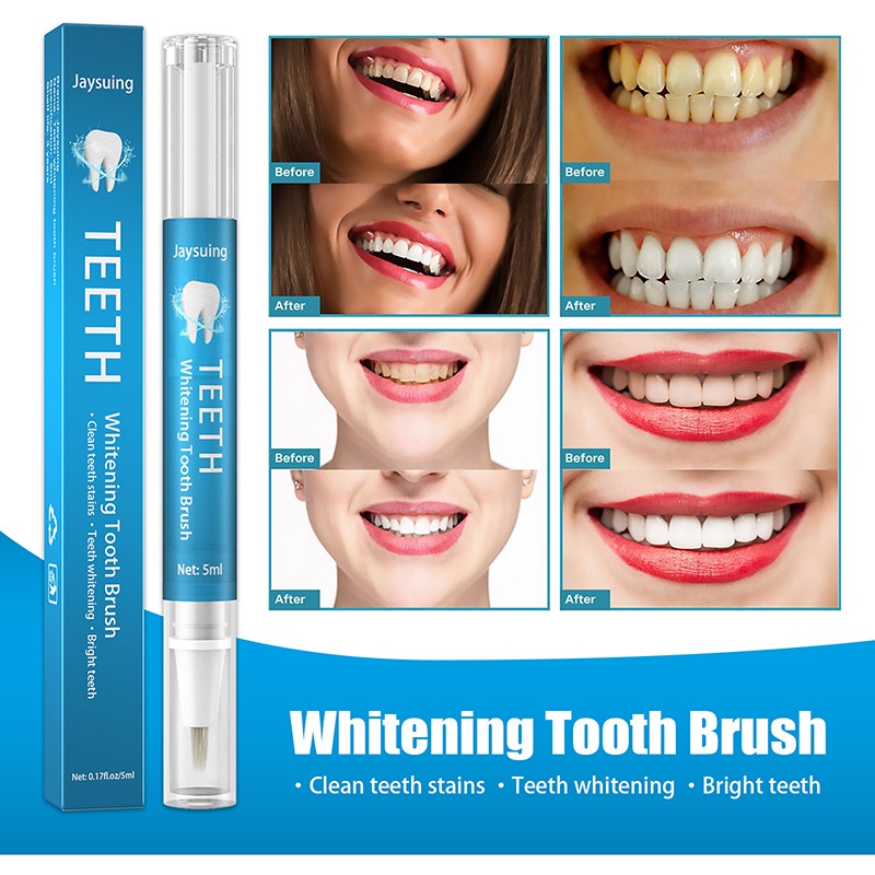 Bút Gel Tẩy Trắng Răng Hiệu Quả