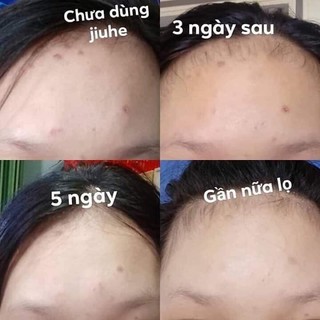 Tính chất giảm thâm Jiuhe