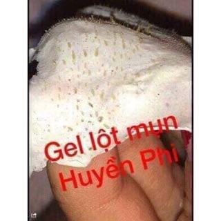 Gel lột mụn Huyền Phi 120k