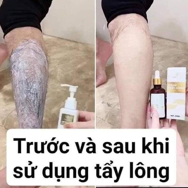 Kem tẩy lông Huyền Phi chính hãng, sạch lông an toàn không đau rát tặng kèm serum