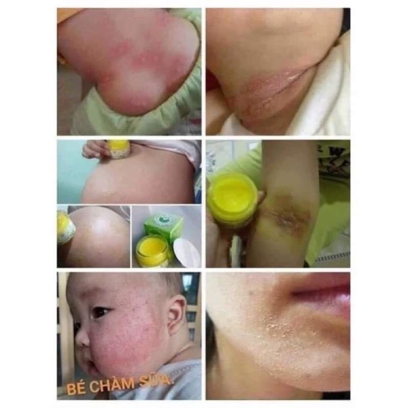 KEM DƯỠNG DA TRẦN KIM HUYỀN