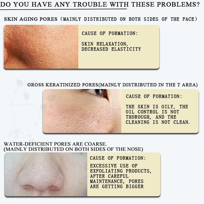 XIXI Tinh chất Hyaluronic Acid dưỡng ẩm chống nếp nhăn làm săn chắc da 10ml
 | BigBuy360 - bigbuy360.vn