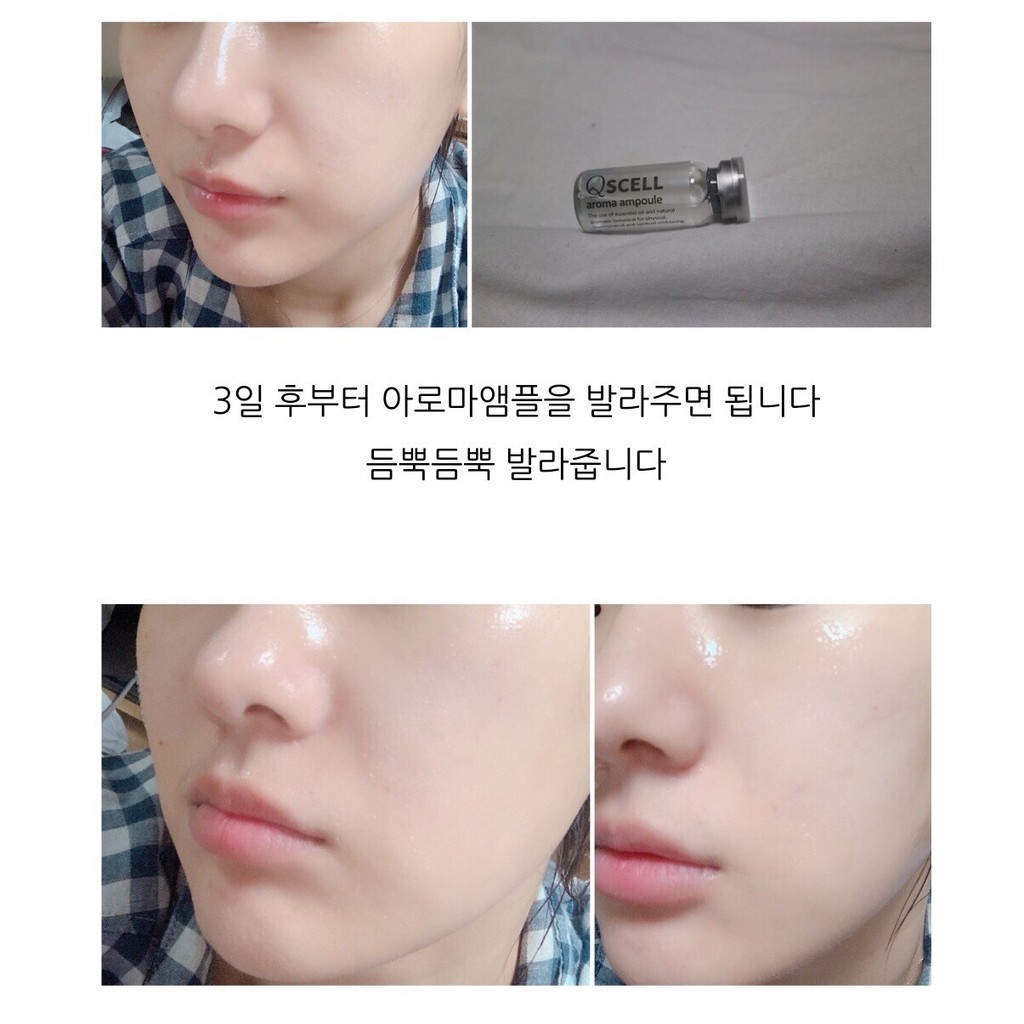 Vi tảo thay da sinh học QSCELL mẫu mới nhất số 1 tại Hàn | BigBuy360 - bigbuy360.vn