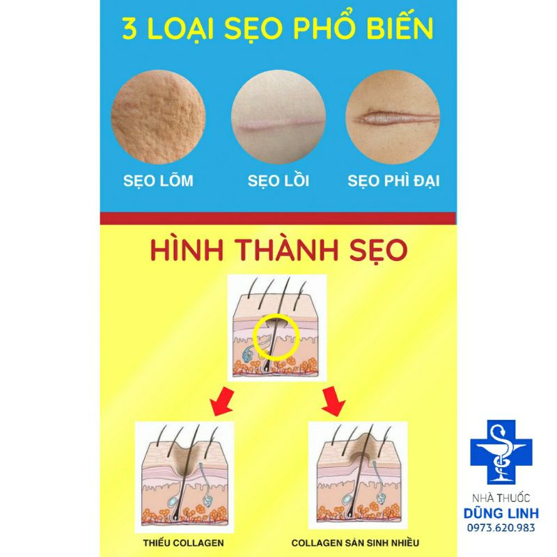 GEL MỜ SẸO HIRUSCAR 5g chính hãng