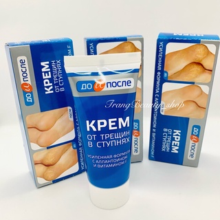 Kem Nứt Gót Chân Kpem Apteka Nga