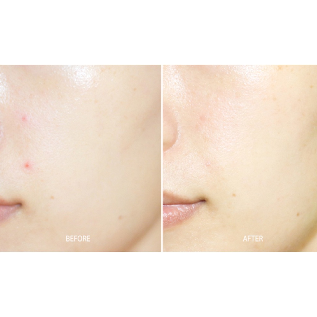 Mặt Nạ Đen Tràm Trà Giảm Mụn đầu đen SexyLook Tea Tree Anti Blemish Black Facial Mask giấy