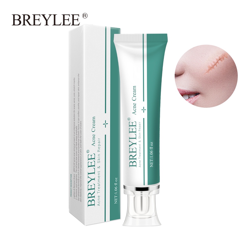 Kem Hỗ Trợ Giảm Sẹo Do Mụn BREYLEE Làm Sáng Da 30g
