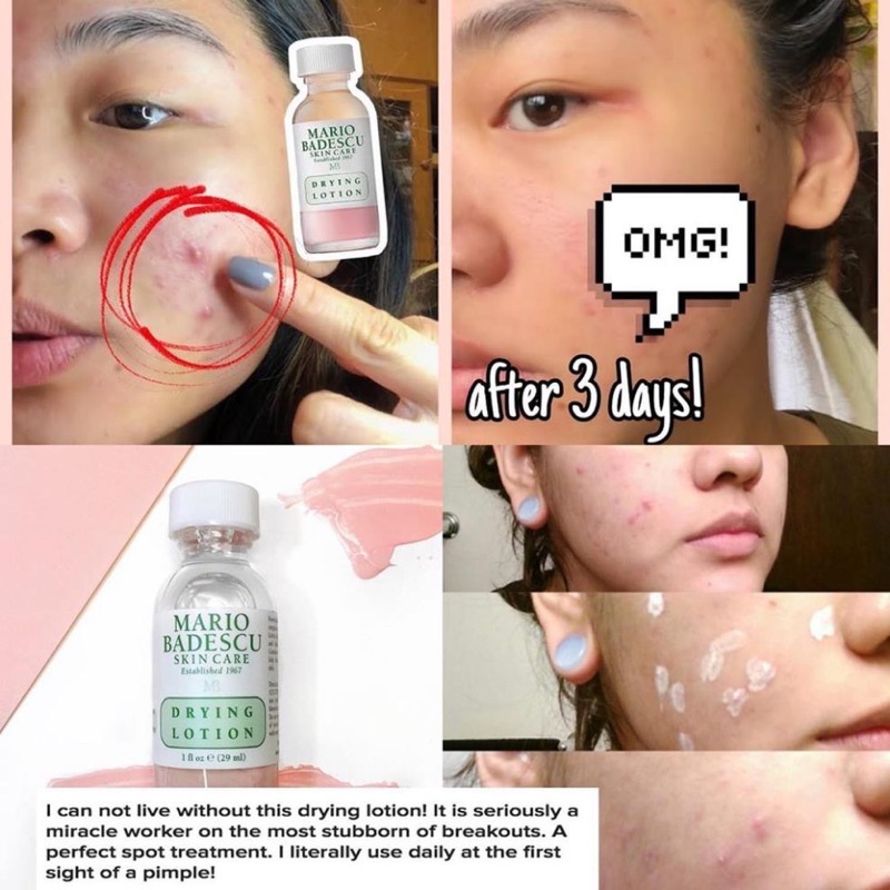 Chấm mụn thần thánh MARIO BADESCU Drying buffering Lotion